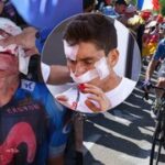 Krvavý konec na Tour, 20 stehů! Rubio vletěl obličejem do auta, které brzdilo před davy